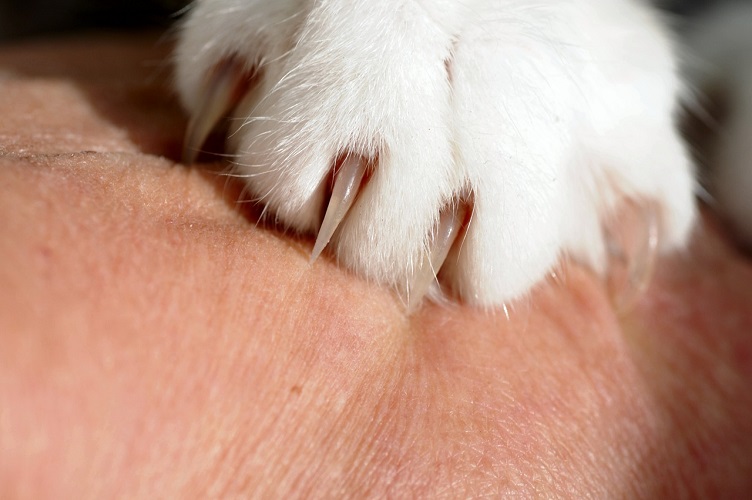 How to Trim Your Cat's Nails